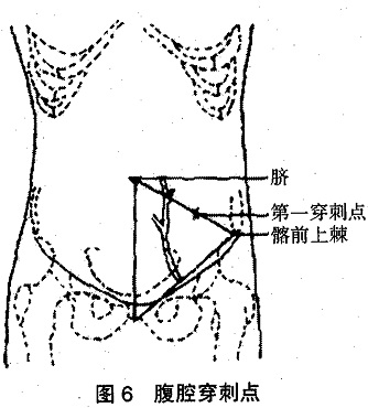 fqcc1